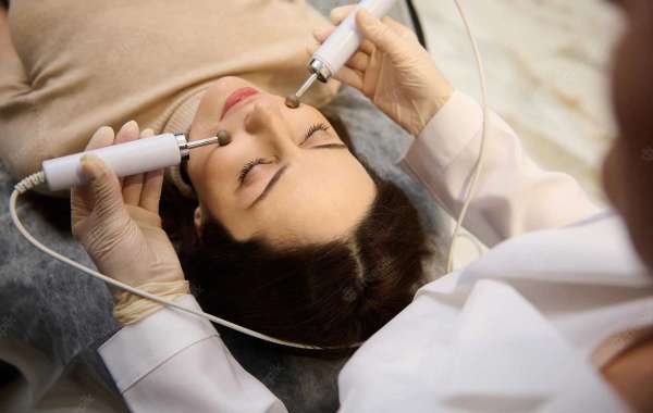 The Best Microdermabrasion Treatment in London, Ontario