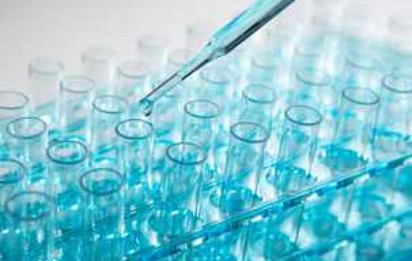 Global Bioprocess Validation Market Size, Overview, Key Players and Forecast 2028