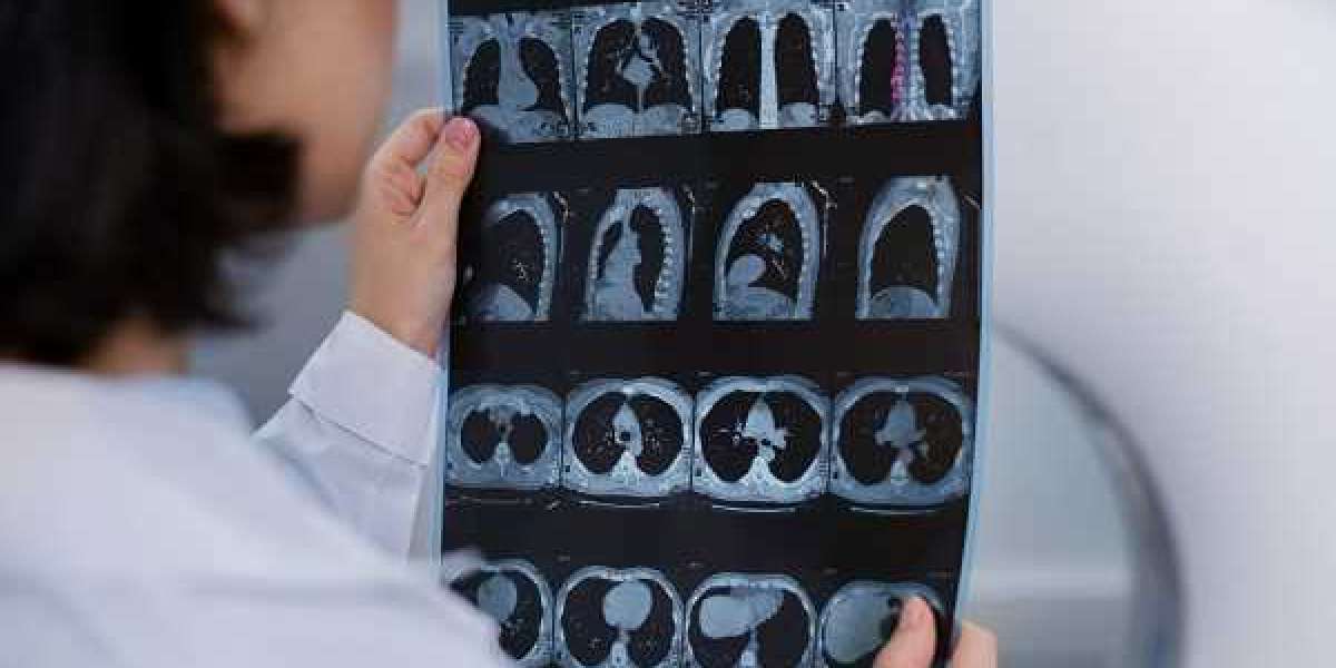 Medical Imaging Market Recent Trends and Developments Analysis 2032