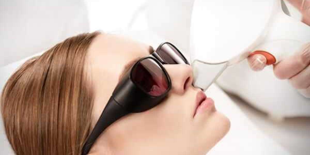 Is laser treatment good for hair removal?