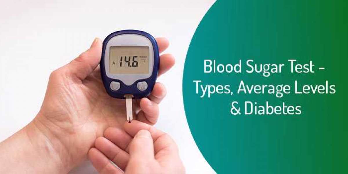 How to Prepare & What to Expect for Blood Sugar Tests