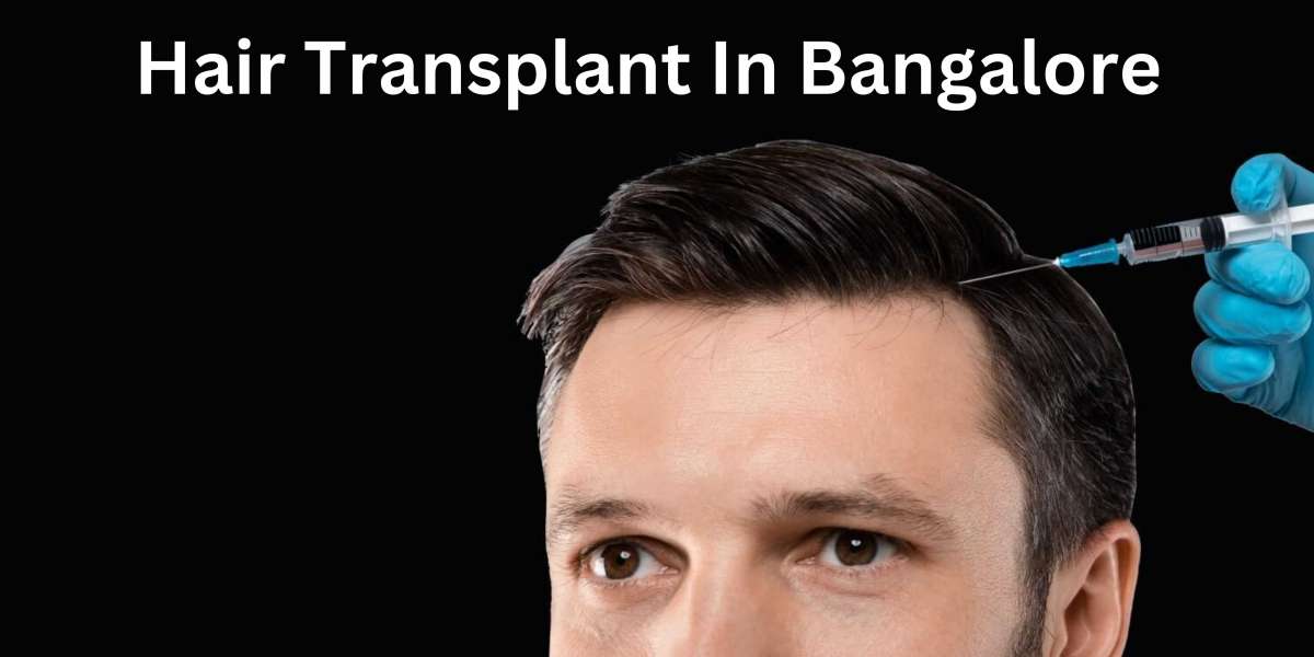 Know all About Revision Hair Transplant: When and Why It’s Needed