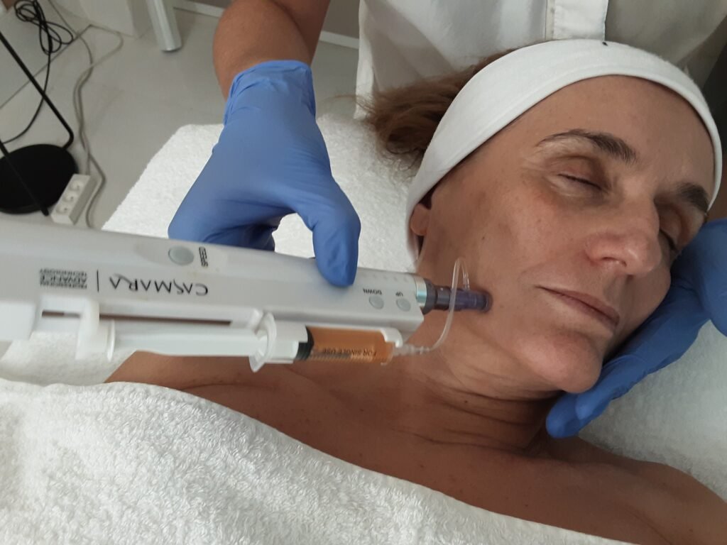 Tratamiento Facial y de Labios con Dermapen en Alicante | Clínica de Tratamientos Faciales y de Labios Dermapen