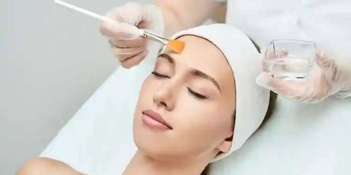 Which is the Best Chemical Peel For Treating Acne Scars?