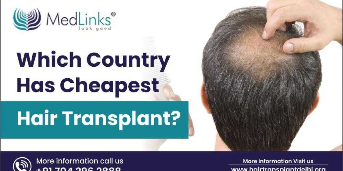 Which Country has the Cheapest Hair Transplant?