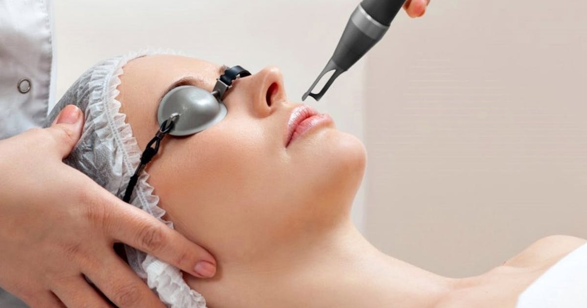 Pre-Wedding Perfection: How Laser Facials Can Transform Your Skin for the Big Day