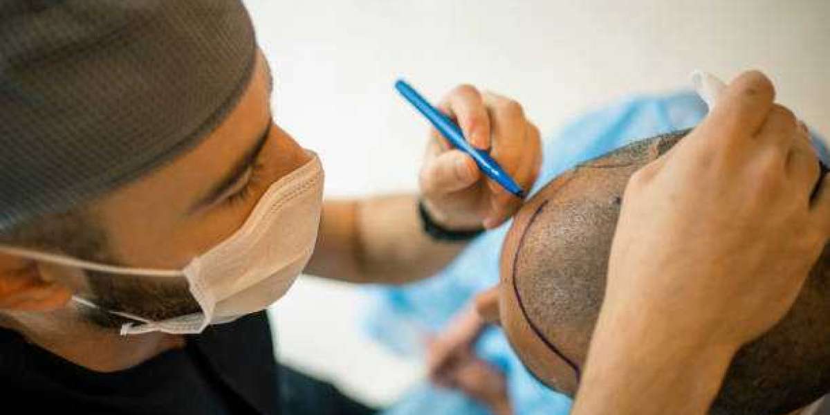 "Hair Restoration Revolution: Exploring the Latest Trends in Riyadh's Transplant Clinics"