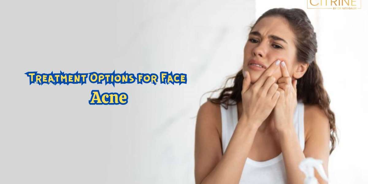 Treatment Options for Face Acne