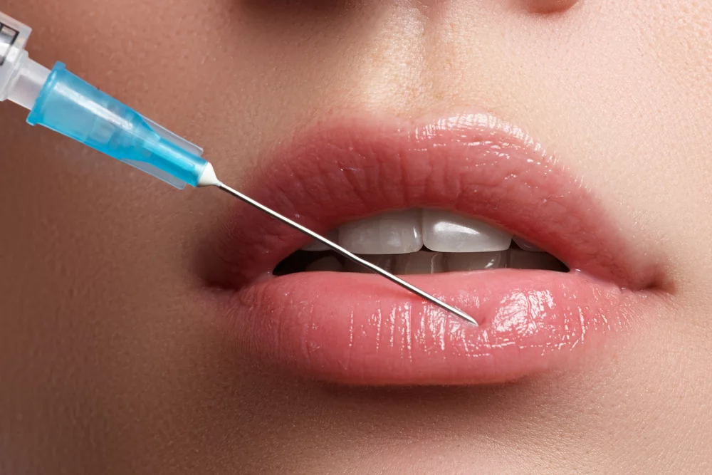 Lip Injections: Enhancing Your Natural Beauty Safely
