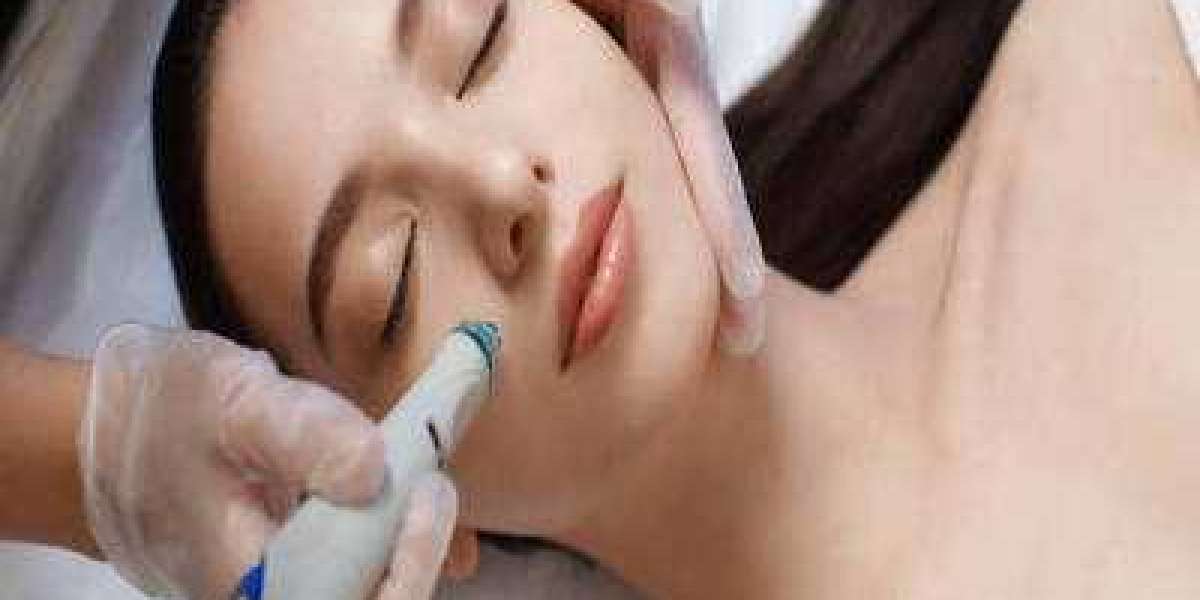 "HydraFacial Treatment in Dubai: Unveiling Radiant Skin"