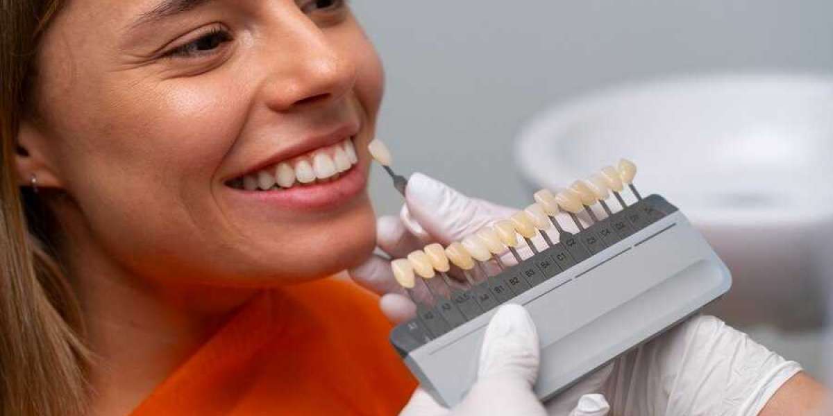 Smile Dentistry: Unlocking the Secrets to a Radiant Smile
