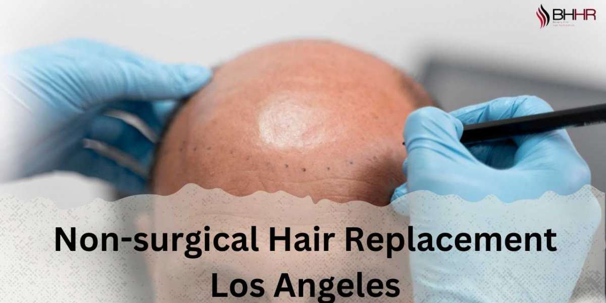 Find the Best Non-Surgical Hair Replacement in Los Angeles