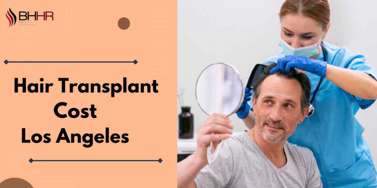 Exploring the Cost of Hair Transplant in Los Angeles