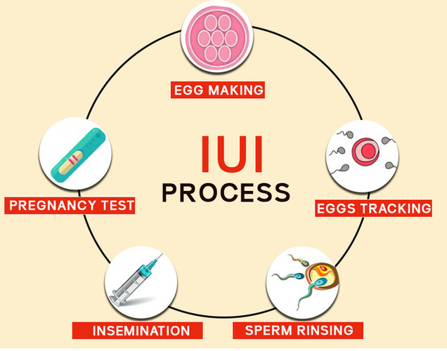 Best IUI Treatment Specialist In New Delhi, Best IUI Treatment Center In South Delhi| Dr. Rupali Bassi