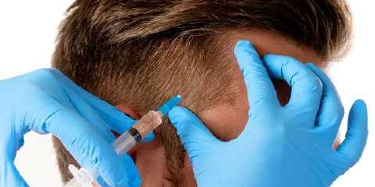 Plasma Injections: Tailoring Hair Restoration for Abu Dhabi Residents