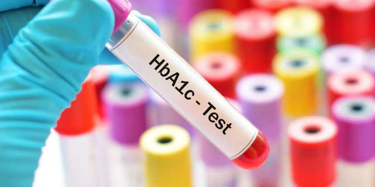 HbA1c Testing Market Size to Surge with Advancements in Diagnostic Technologies