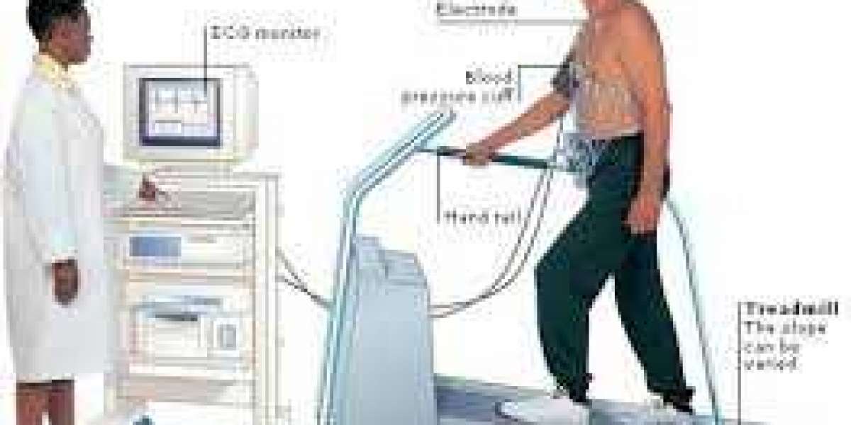 Treadmill Test Near Me: A Comprehensive Guide to Understanding Stress Tests