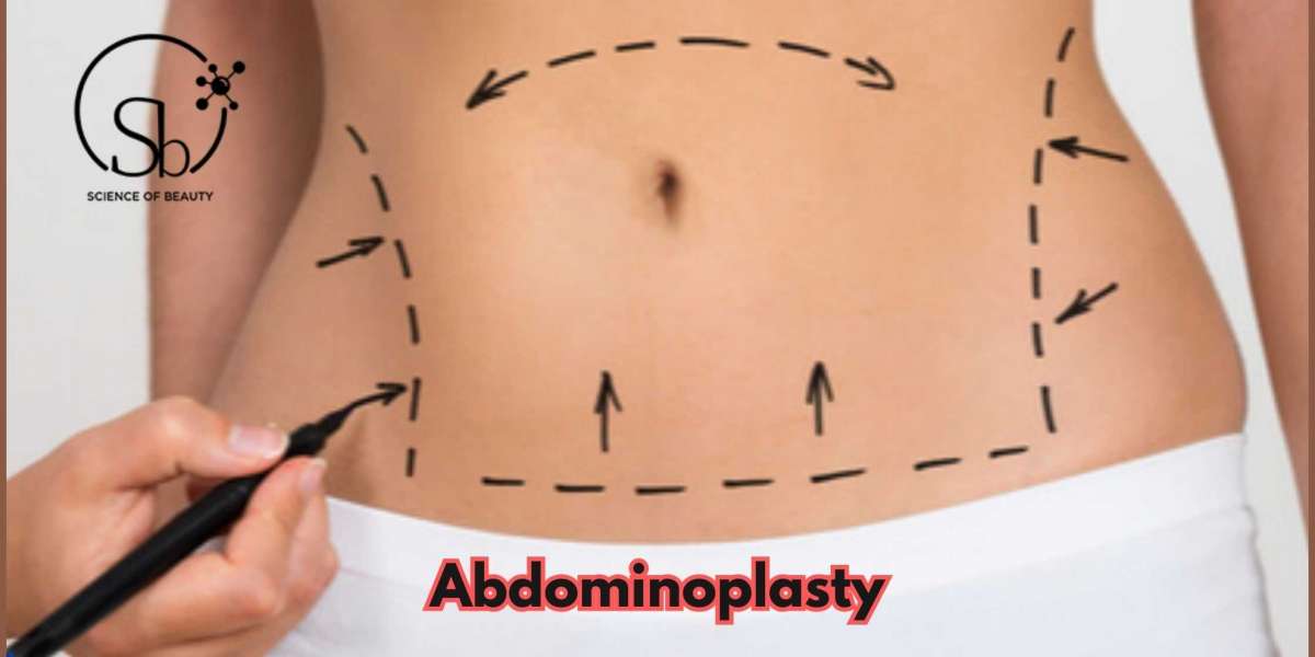 Everything You Need To Know About Abdominoplasty