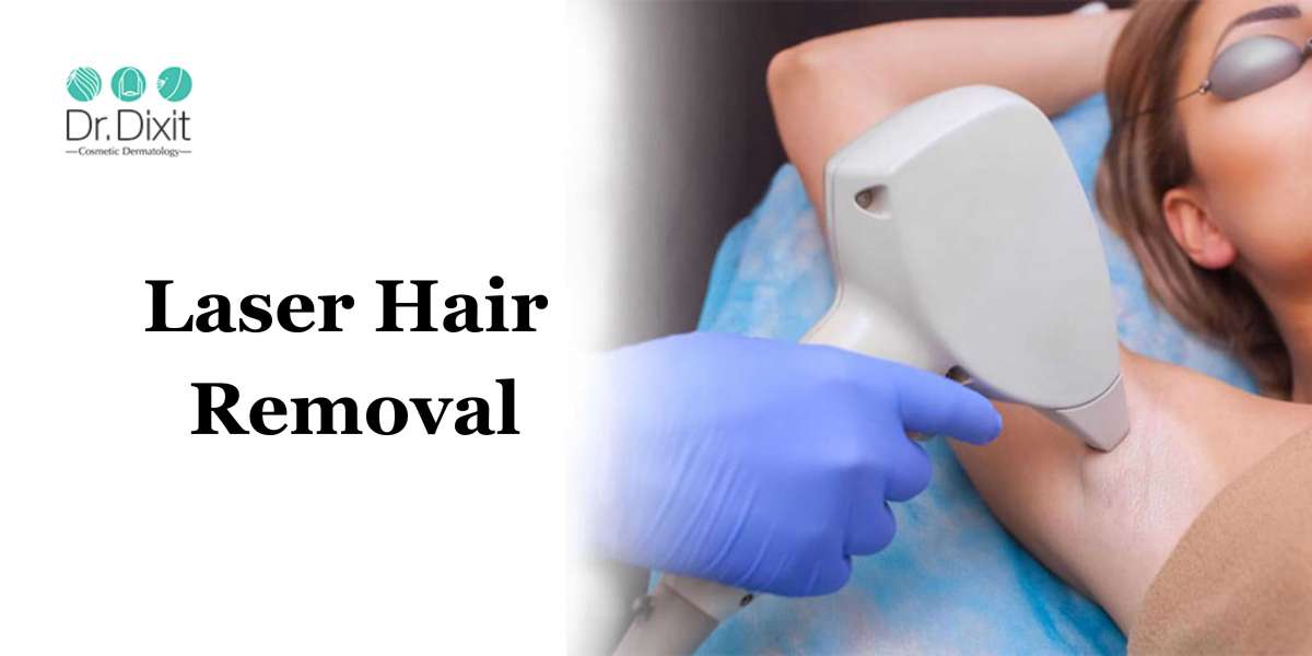 How Long Does Laser Hair Removal Last? Get the Facts