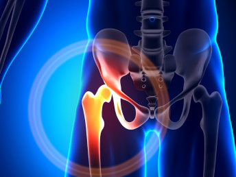 Best Hip Replacement surgeon in Bariatu Ranchi | Dr.Ankur Saurav