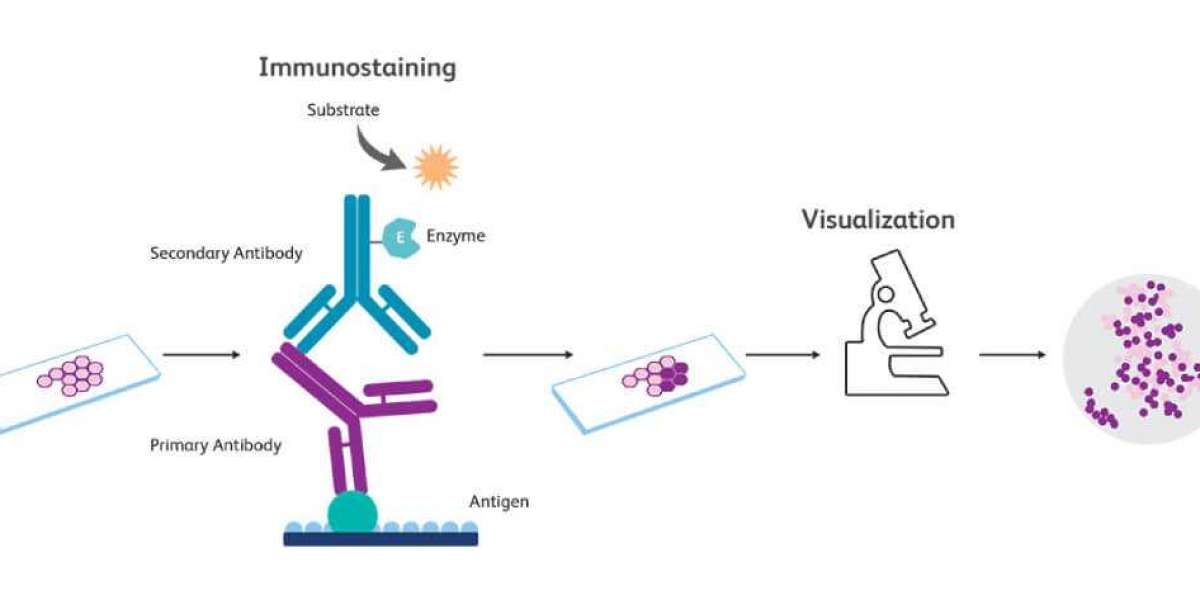 Immunohistochemistry  Promising Growth and by Platform Type, Technology and End User Industry Statistics, Scope, Demand 