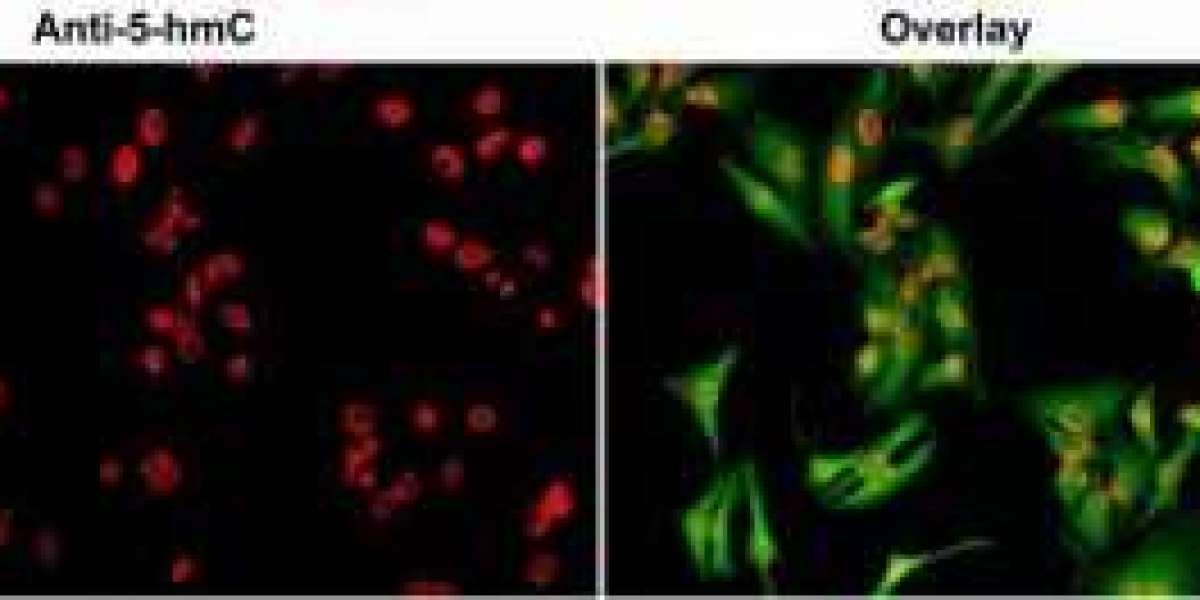 Creative Diagnostics Announces Cutting-Edge DNA/RNA Methylation Antibodies for Cancer Research