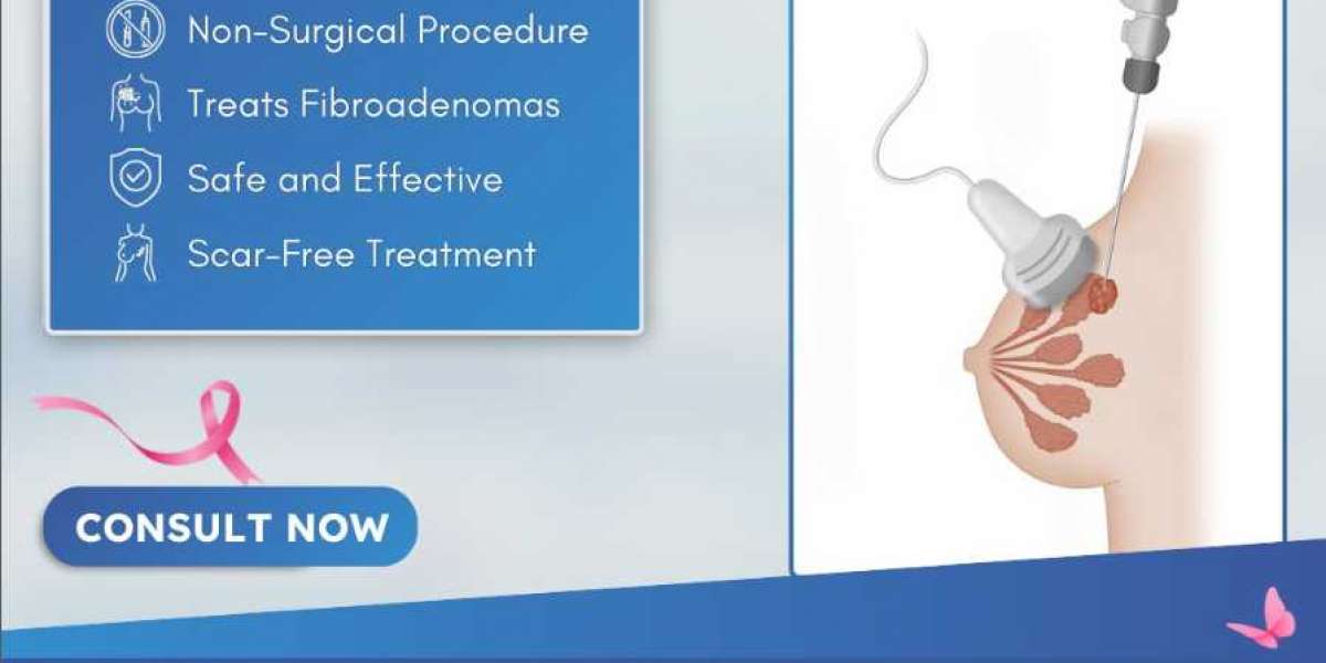 Dr. Shilpy Dolas Provides Leading Fibroadenoma Treatment in Pune