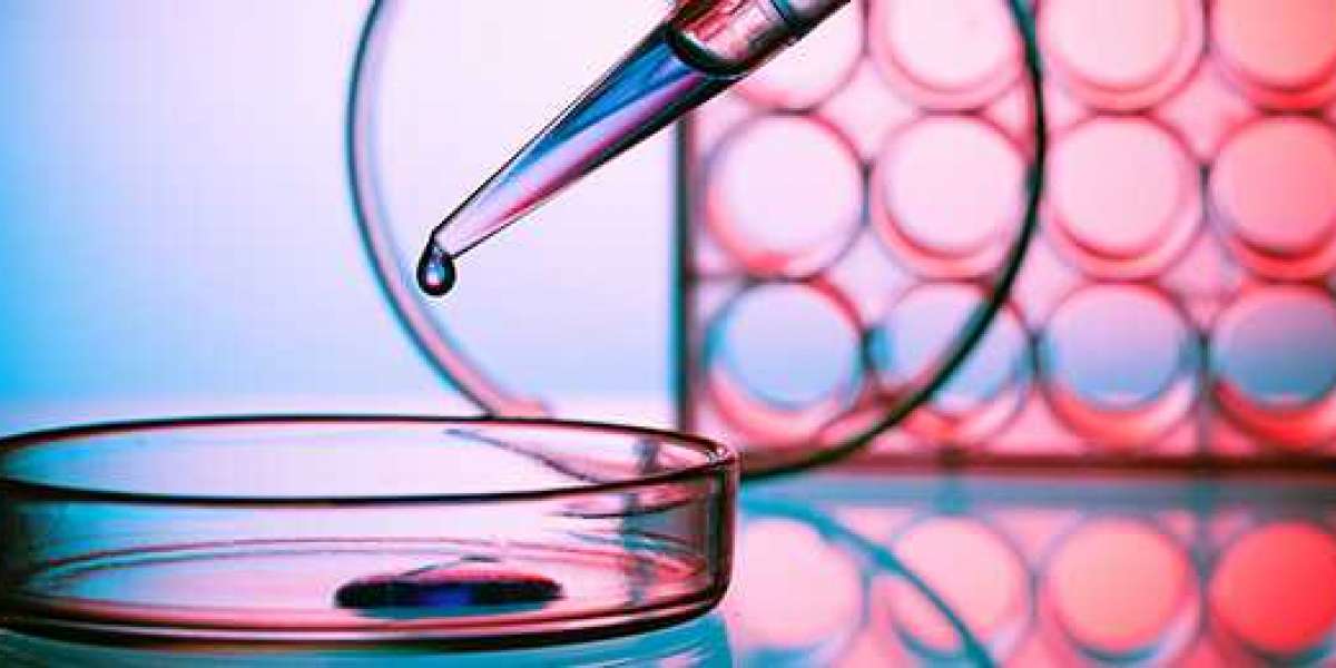 Introduction to Roxburgh Superoxide Dismutase