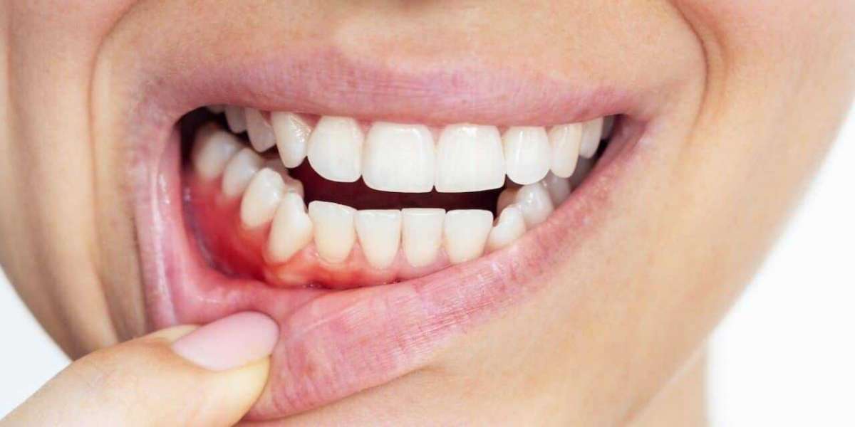 Smile Vegas Dental: Elevating Dental Care Standards in Las Vegas