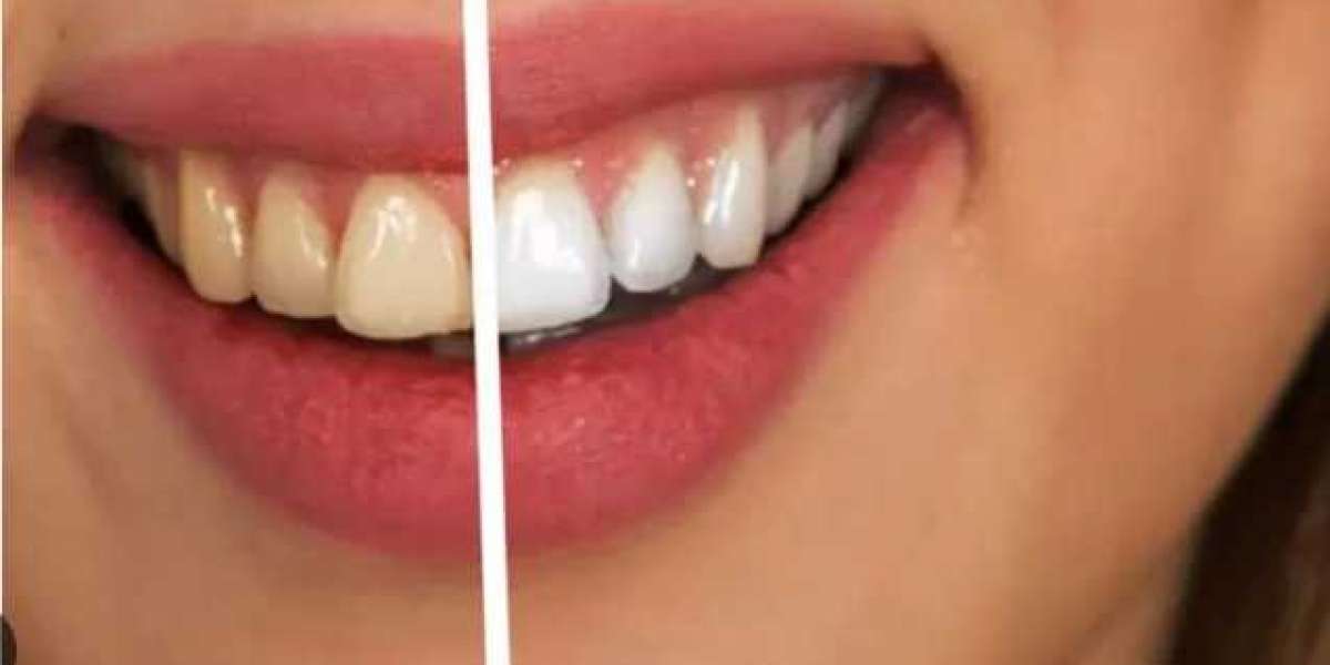 Paynless Dental – Your Trusted Dental Care Provider in Westmead & Baulkham Hills