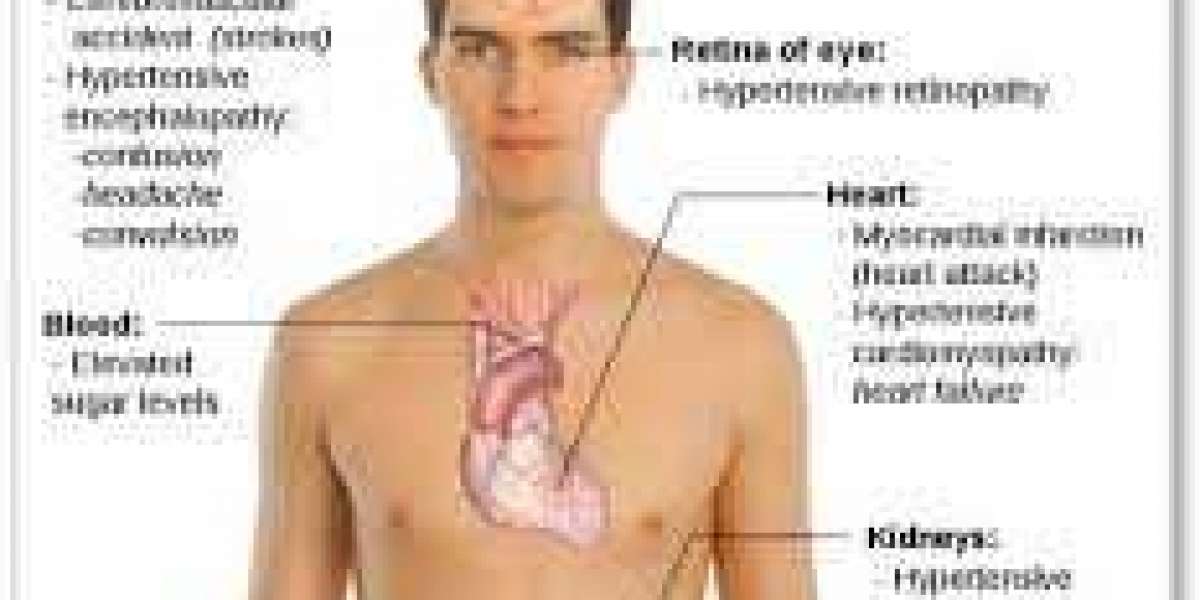 High Blood Pressure (Hypertension): Symptoms and Solutions