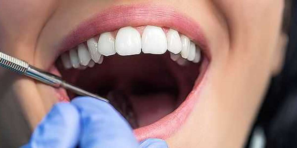 Comprehensive Guide to Root Canal Treatment in Wallan: Everything You Need to Know