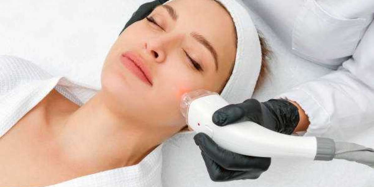 A Beauty Transformation with Laser Hair Removal and Lip Fillers