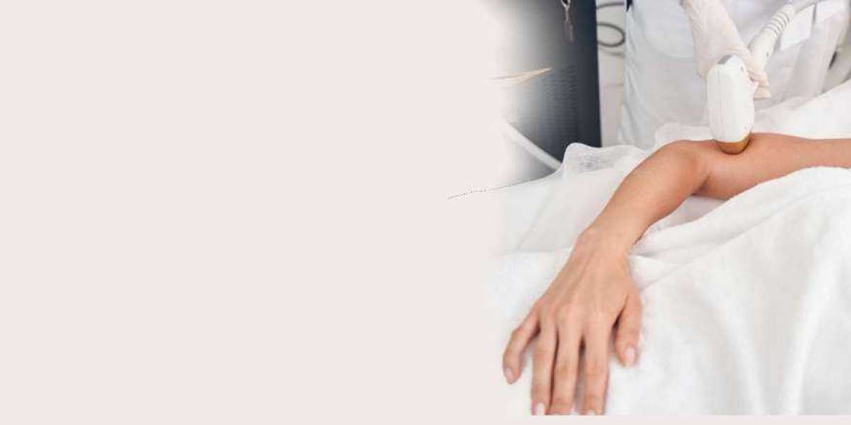 Can Hirsutism be Managed With Laser Hair Removal?