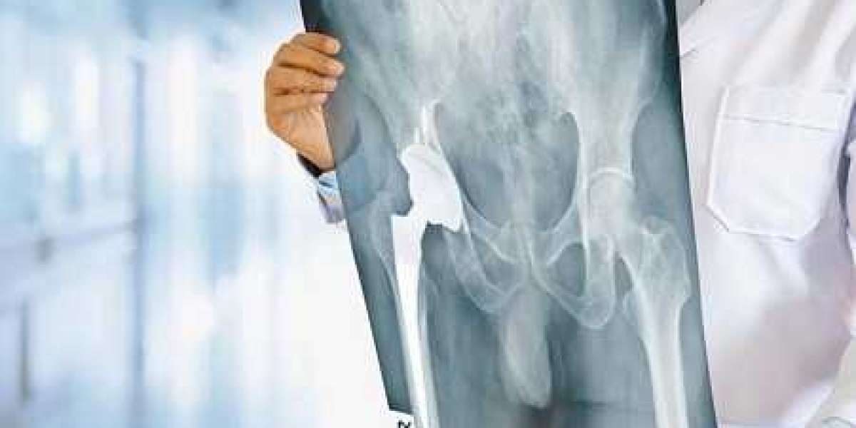 From Limping to Living: Real Stories from Patients Who Chose the Best Knee Replacement Surgeon in Nagpur