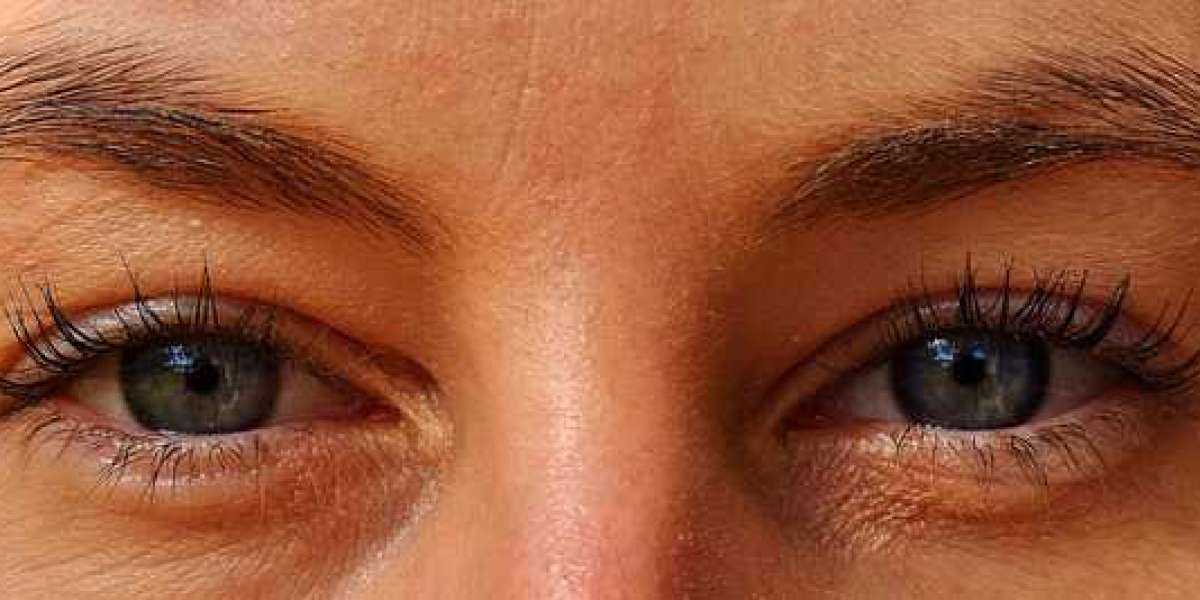 what are hooded eyes?