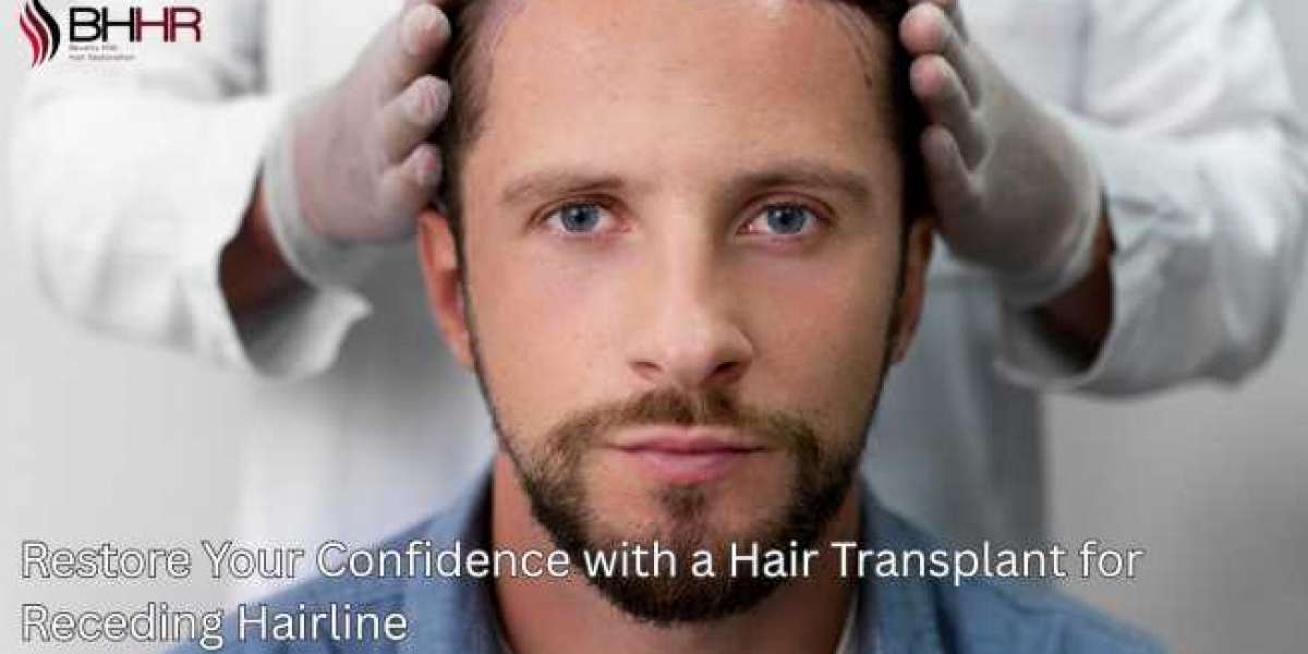 Restore Your Confidence with a Hair Transplant for Receding Hairline