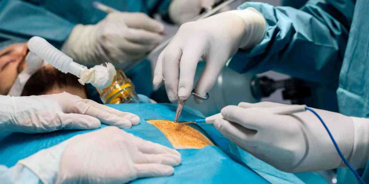 Top Laparoscopic Surgery in Islamabad for Safe Healing